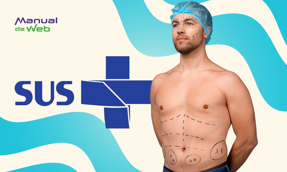 Como fazer cirurgia plástica gratuita pelo SUS: guia completo